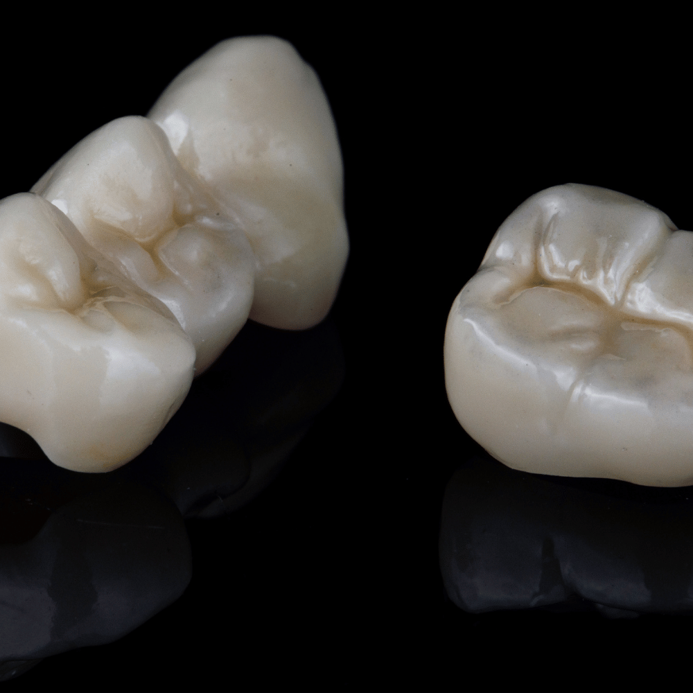 Kronen en brugwerk nieuw