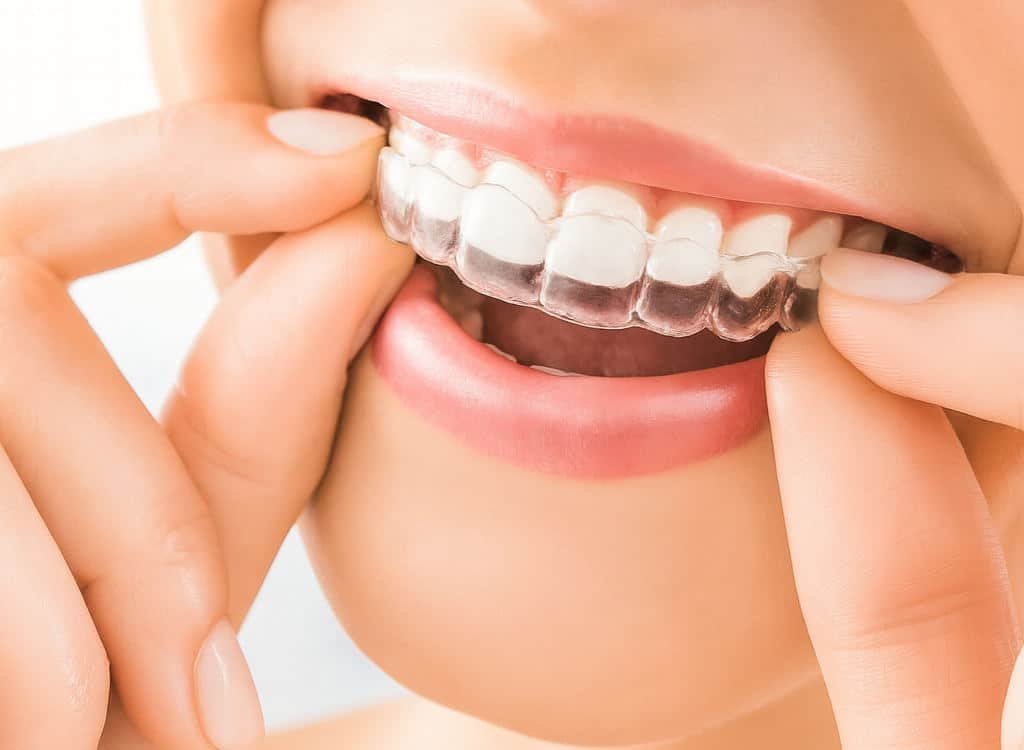 Persoon plaatst doorzichtige beugel in