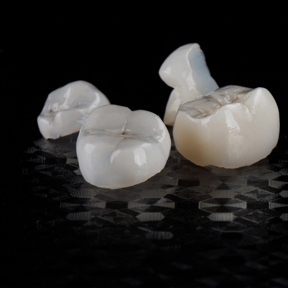 CEREC kroon in één dag geplaatst bij Tandartspraktijk Het Oude Dorp